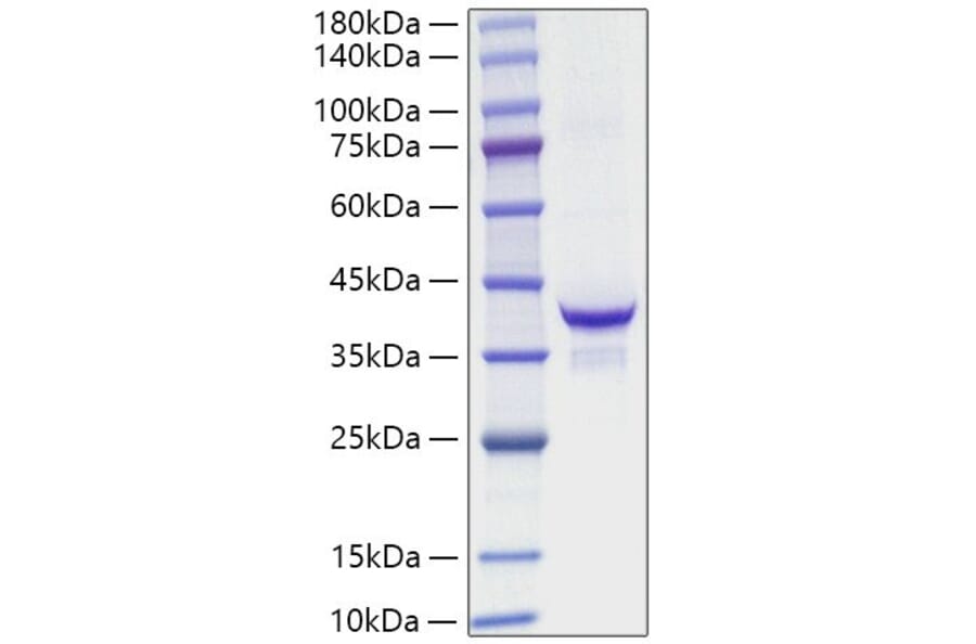SDS-PAGE - Recombinant Mouse IGF1 Protein (C-terminal Human Fc Tag) (A331648) - Antibodies.com