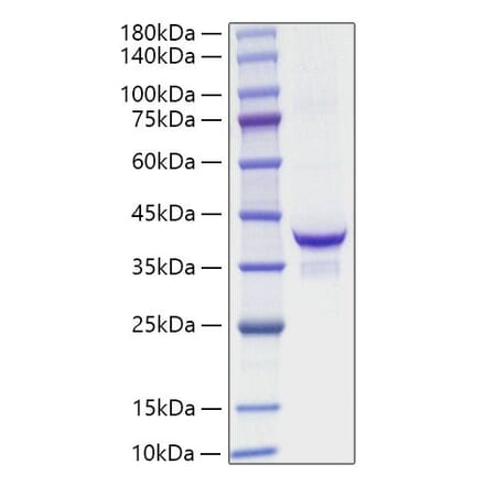 SDS-PAGE - Recombinant Mouse IGF1 Protein (C-terminal Human Fc Tag) (A331648) - Antibodies.com