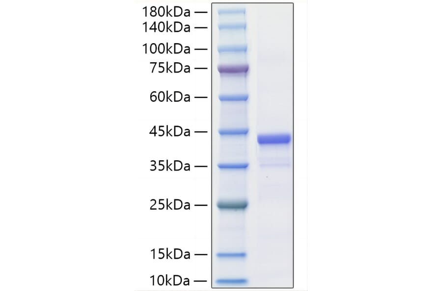 SDS-PAGE - Recombinant Mouse IGF1 Protein (C-terminal Human Fc Tag) (A331651) - Antibodies.com