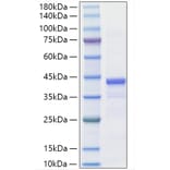 SDS-PAGE - Recombinant Mouse IGF1 Protein (C-terminal Human Fc Tag) (A331651) - Antibodies.com