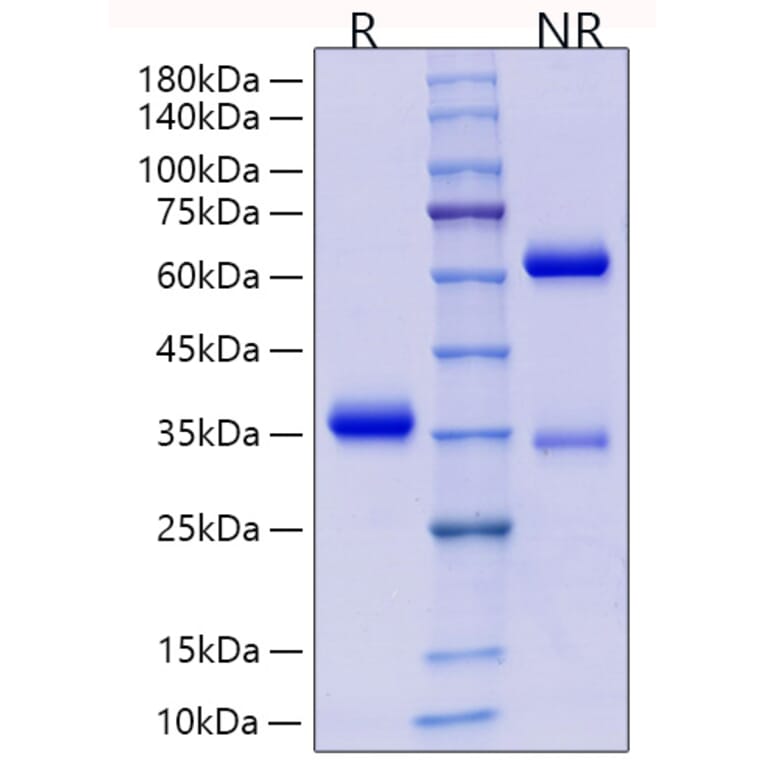 SDS-PAGE - Recombinant Human IgG4 Protein (C-terminal His Tag) (A331657) - Antibodies.com