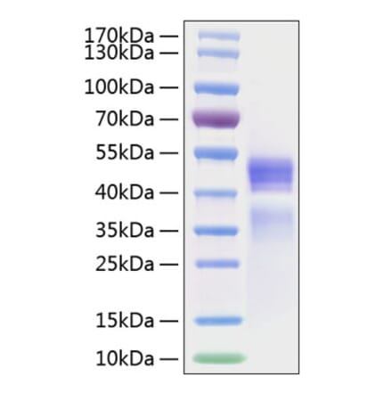 SDS-PAGE - Recombinant Human IL-12A + IL-12B Protein (C-terminal His (IL12B) and Flag Tag (IL12A)) (A331659) - Antibodies.com