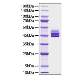 SDS-PAGE - Recombinant Mouse IL-12B Protein (C-terminal His Tag) (A331662) - Antibodies.com