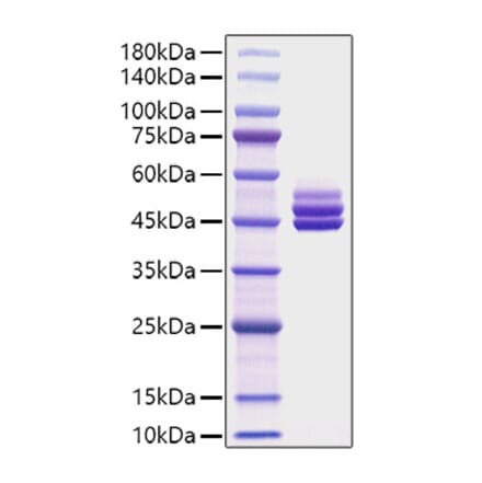 SDS-PAGE - Recombinant Mouse IL-12B Protein (C-terminal His Tag) (A331662) - Antibodies.com