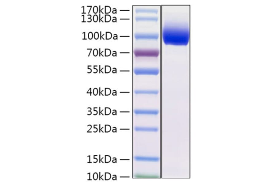 SDS-PAGE - Recombinant Mouse IL-13 Receptor alpha 1 Protein (C-terminal Fc Tag) (A331664) - Antibodies.com