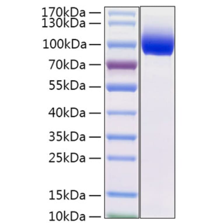 SDS-PAGE - Recombinant Mouse IL-13 Receptor alpha 1 Protein (C-terminal Fc Tag) (A331664) - Antibodies.com