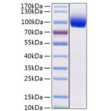 SDS-PAGE - Recombinant Mouse IL-13 Receptor alpha 1 Protein (C-terminal Fc Tag) (A331664) - Antibodies.com