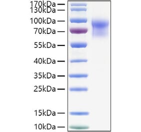 SDS-PAGE - Recombinant Mouse IL-15RA Protein (C-terminal Human Fc and His Tag) (A331666) - Antibodies.com