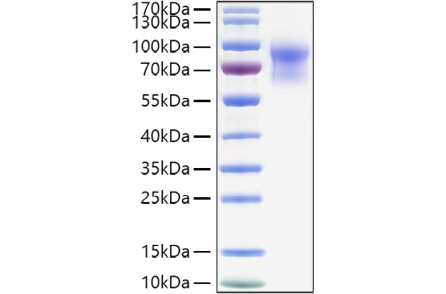 SDS-PAGE - Recombinant Mouse IL-15RA Protein (C-terminal Human Fc and His Tag) (A331666) - Antibodies.com
