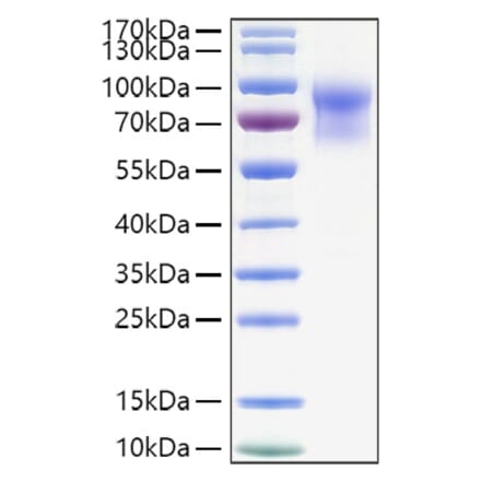SDS-PAGE - Recombinant Mouse IL-15RA Protein (C-terminal Human Fc and His Tag) (A331666) - Antibodies.com