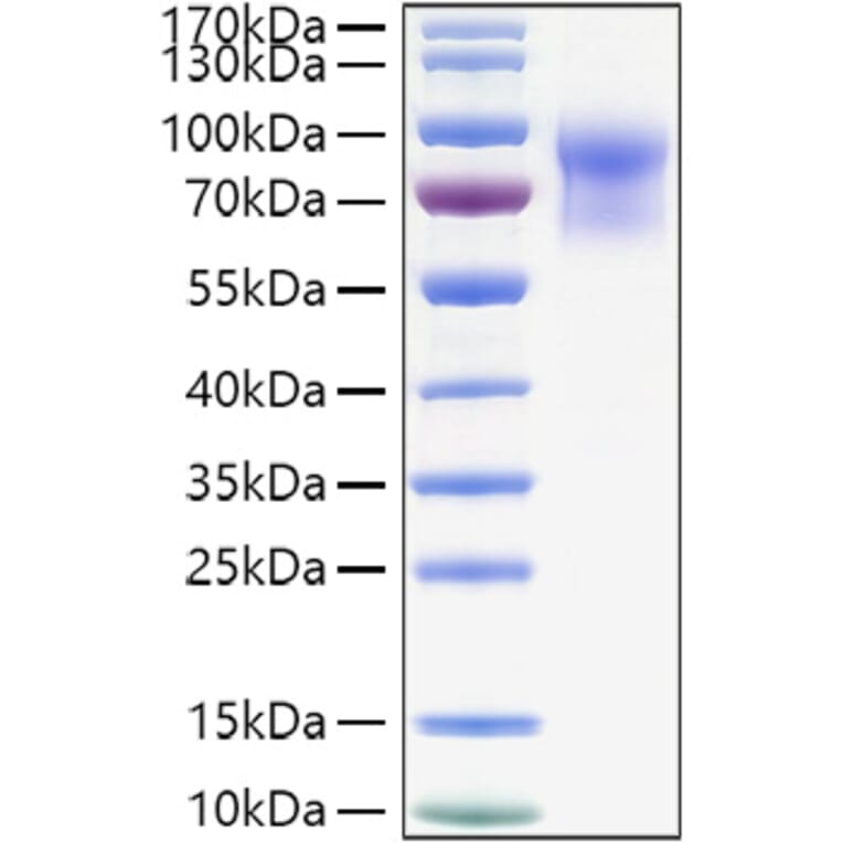 SDS-PAGE - Recombinant Mouse IL-15RA Protein (C-terminal Human Fc and His Tag) (A331666) - Antibodies.com