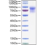 SDS-PAGE - Recombinant Mouse IL-15RA Protein (C-terminal Human Fc and His Tag) (A331666) - Antibodies.com
