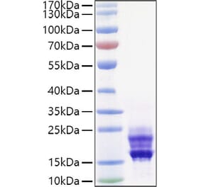 SDS-PAGE - Recombinant Mouse IL-17A Protein (C-terminal His Tag) (A331670) - Antibodies.com