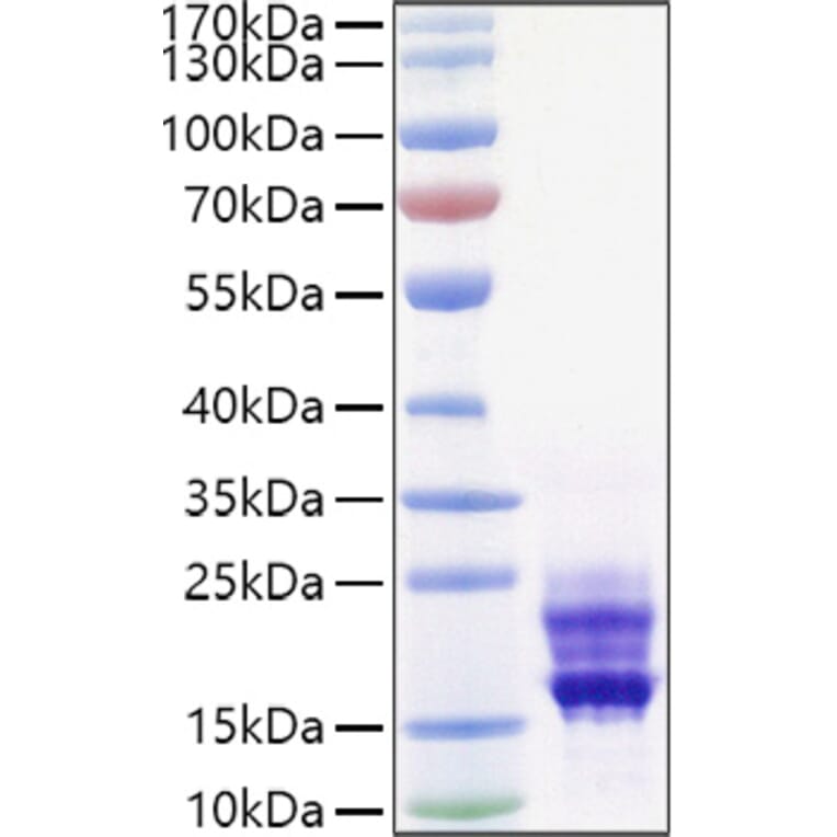 SDS-PAGE - Recombinant Mouse IL-17A Protein (C-terminal His Tag) (A331670) - Antibodies.com
