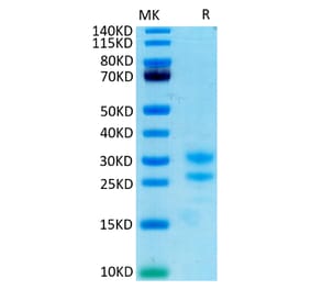 Tris-Bis PAGE - Recombinant Cynomolgus macaque IL-17A Protein (C-terminal His and Avi Tag) (A331671) - Antibodies.com