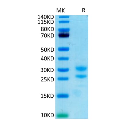 Tris-Bis PAGE - Recombinant Cynomolgus macaque IL-17A Protein (C-terminal His and Avi Tag) (A331671) - Antibodies.com