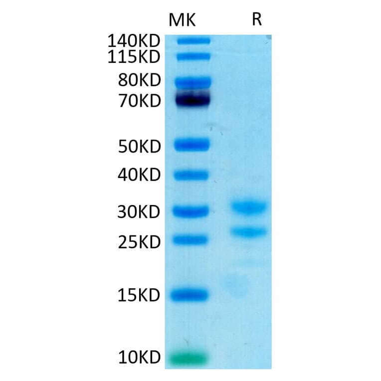 Tris-Bis PAGE - Recombinant Cynomolgus macaque IL-17A Protein (C-terminal His and Avi Tag) (A331671) - Antibodies.com