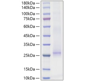 SDS-PAGE - Recombinant Mouse IL-17E Protein (N-terminal His Tag) (A331672) - Antibodies.com