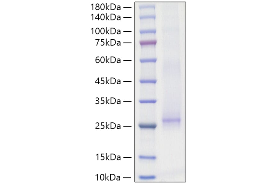 SDS-PAGE - Recombinant Mouse IL-17E Protein (N-terminal His Tag) (A331672) - Antibodies.com