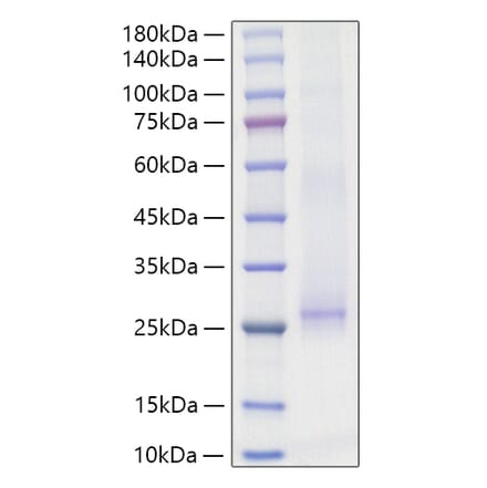 SDS-PAGE - Recombinant Mouse IL-17E Protein (N-terminal His Tag) (A331672) - Antibodies.com