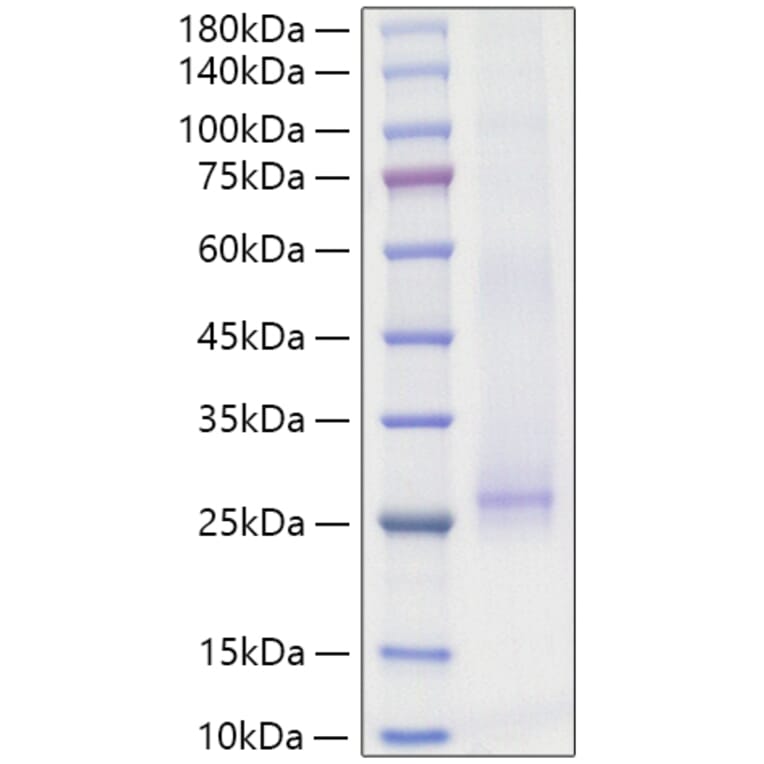 SDS-PAGE - Recombinant Mouse IL-17E Protein (N-terminal His Tag) (A331672) - Antibodies.com