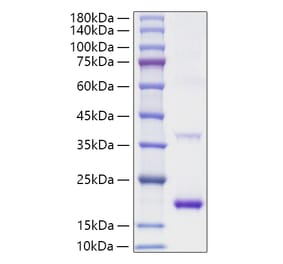 SDS-PAGE - Recombinant Mouse IL-1RA Protein (A331674) - Antibodies.com