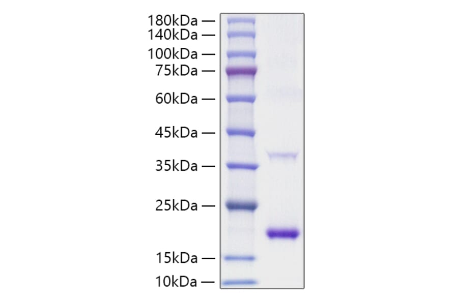 SDS-PAGE - Recombinant Mouse IL-1RA Protein (A331674) - Antibodies.com