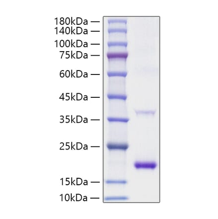 SDS-PAGE - Recombinant Mouse IL-1RA Protein (A331674) - Antibodies.com