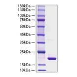 SDS-PAGE - Recombinant Rat IL-1RA Protein (A331675) - Antibodies.com