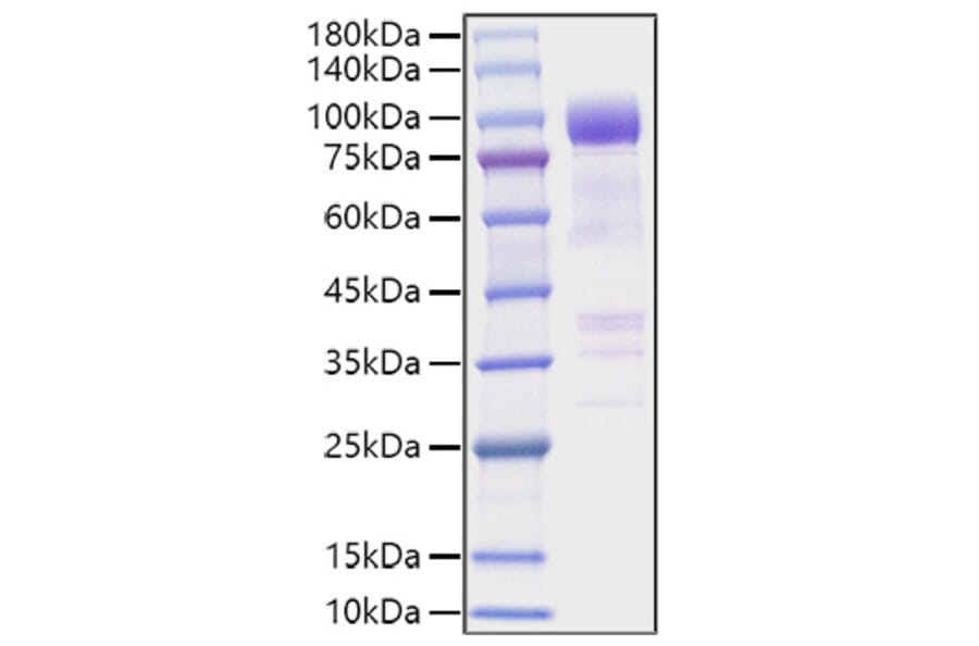 SDS-PAGE - Recombinant Mouse ST2 Protein (C-terminal Human Fc Tag) (A331676) - Antibodies.com