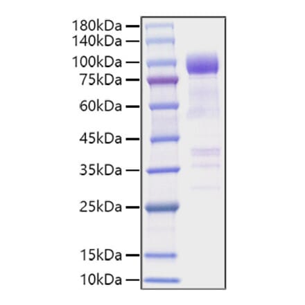SDS-PAGE - Recombinant Mouse ST2 Protein (C-terminal Human Fc Tag) (A331676) - Antibodies.com