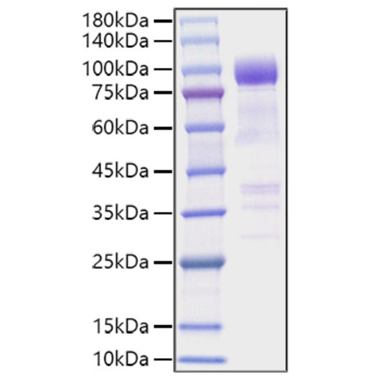 SDS-PAGE - Recombinant Mouse ST2 Protein (C-terminal Human Fc Tag) (A331676) - Antibodies.com