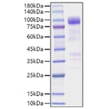 SDS-PAGE - Recombinant Mouse ST2 Protein (C-terminal Human Fc Tag) (A331676) - Antibodies.com