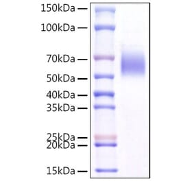 SDS-PAGE - Recombinant Mouse ST2 Protein (C-terminal His Tag) (A331677) - Antibodies.com