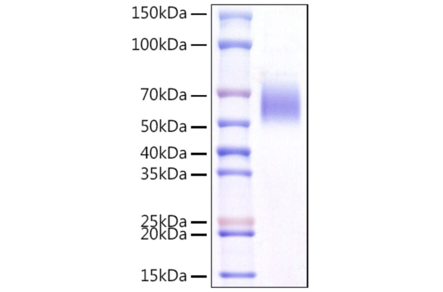 SDS-PAGE - Recombinant Mouse ST2 Protein (C-terminal His Tag) (A331677) - Antibodies.com