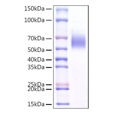 SDS-PAGE - Recombinant Mouse ST2 Protein (C-terminal His Tag) (A331677) - Antibodies.com