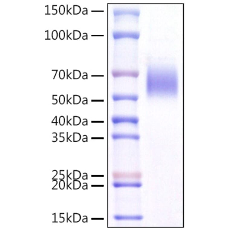 SDS-PAGE - Recombinant Mouse ST2 Protein (C-terminal His Tag) (A331677) - Antibodies.com