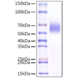 SDS-PAGE - Recombinant Mouse ST2 Protein (C-terminal His Tag) (A331677) - Antibodies.com