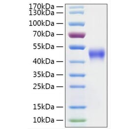 SDS-PAGE - Recombinant Mouse IL2 Receptor beta Protein (C-terminal His Tag) (A331678) - Antibodies.com
