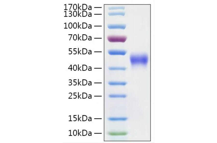 SDS-PAGE - Recombinant Mouse IL2 Receptor beta Protein (C-terminal His Tag) (A331678) - Antibodies.com