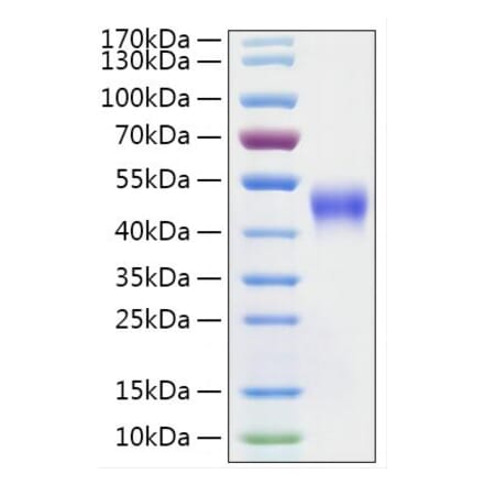 SDS-PAGE - Recombinant Mouse IL2 Receptor beta Protein (C-terminal His Tag) (A331678) - Antibodies.com