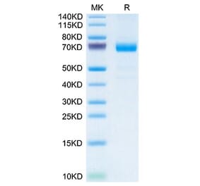 Tris-Bis PAGE - Recombinant Mouse IL20RA Protein (C-terminal Human Fc Tag) (A331679) - Antibodies.com