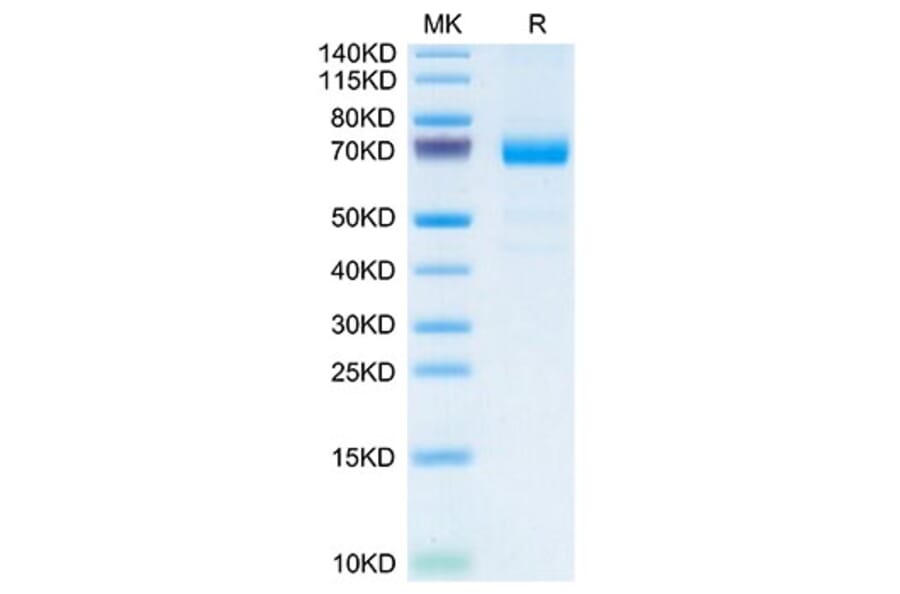 Tris-Bis PAGE - Recombinant Mouse IL20RA Protein (C-terminal Human Fc Tag) (A331679) - Antibodies.com
