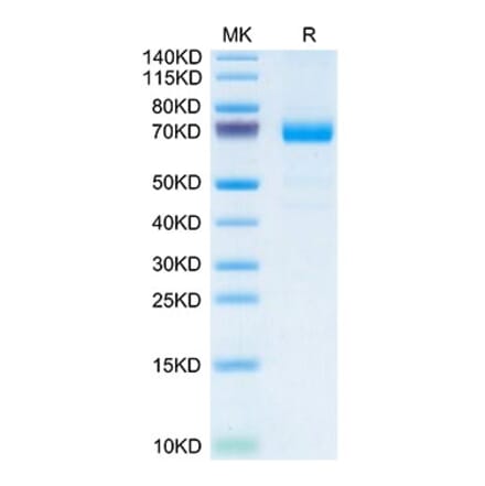 Tris-Bis PAGE - Recombinant Mouse IL20RA Protein (C-terminal Human Fc Tag) (A331679) - Antibodies.com