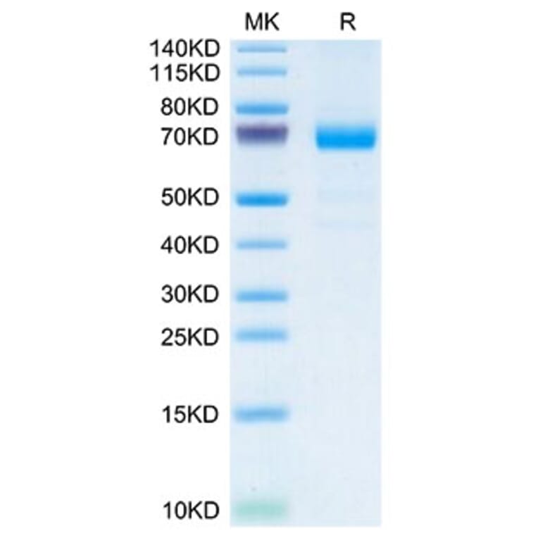 Tris-Bis PAGE - Recombinant Mouse IL20RA Protein (C-terminal Human Fc Tag) (A331679) - Antibodies.com