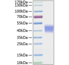 SDS-PAGE - Recombinant Mouse IL-21R Protein (C-terminal His Tag) (A331680) - Antibodies.com