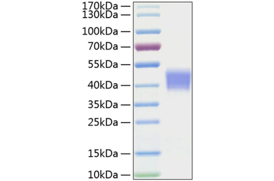 SDS-PAGE - Recombinant Mouse IL-21R Protein (C-terminal His Tag) (A331680) - Antibodies.com