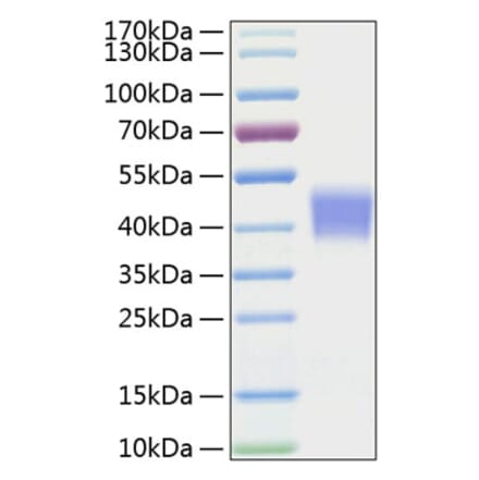 SDS-PAGE - Recombinant Mouse IL-21R Protein (C-terminal His Tag) (A331680) - Antibodies.com