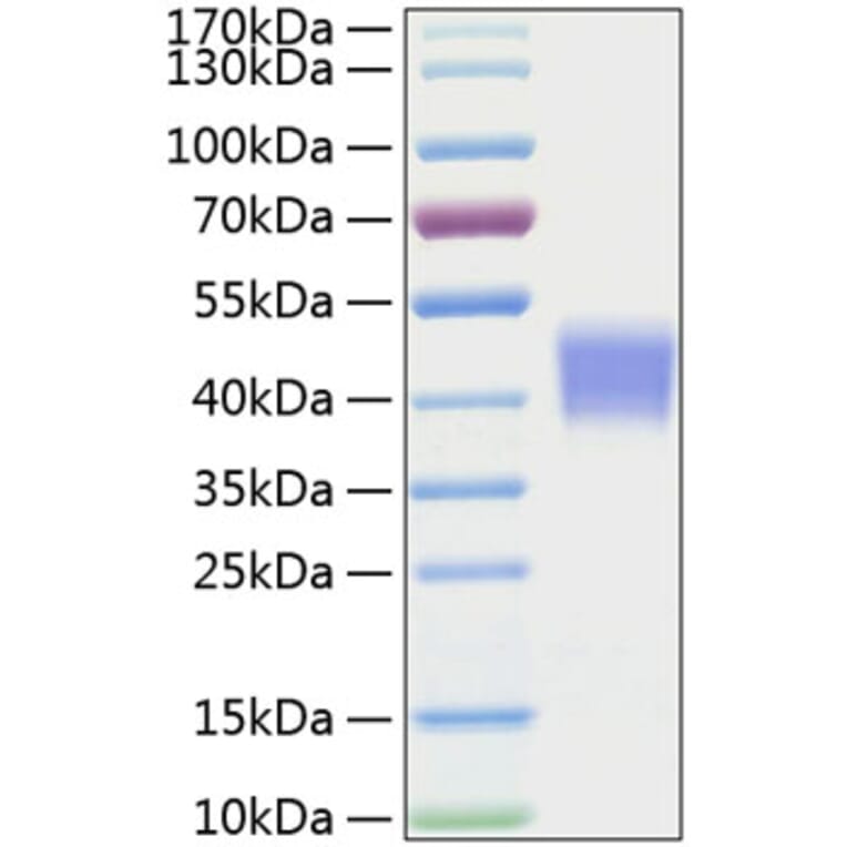 SDS-PAGE - Recombinant Mouse IL-21R Protein (C-terminal His Tag) (A331680) - Antibodies.com