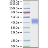 SDS-PAGE - Recombinant Mouse IL-21R Protein (C-terminal His Tag) (A331680) - Antibodies.com
